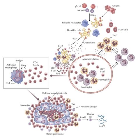 Pathogenesis Of Granuloma Formation Resident Cells Initiate An Immune