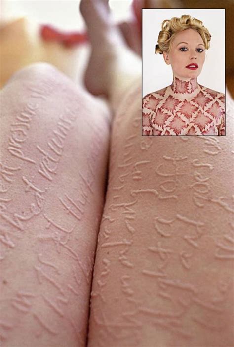 Artist Produces Temporary Works By Etching Her Oversensitive Skin