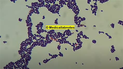 Enterococcus Introduction Morphology Pathogenicity Lab Diag
