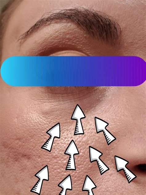 How To Treat Under Eye Wrinkles R30plusskincare