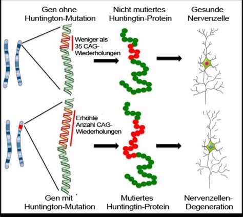 The earliest symptoms are often subtle problems with mood or mental abilities. Chorea Huntington: Hilfe durch Stammzellen? | Eurostemcell