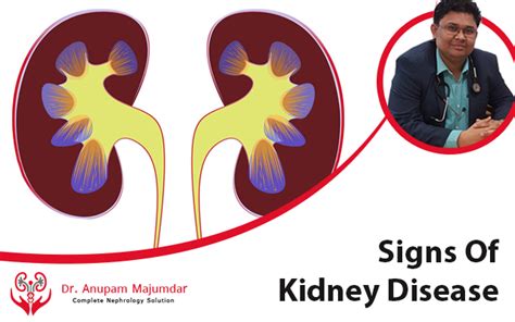 Signs Of Kidney Disease Dr Anupam Majumdar