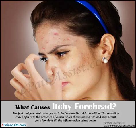 Forehead Rash Causes