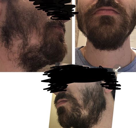 7 Week Quarantine Beard Worth It To Continue Or Gaps Too Large If I