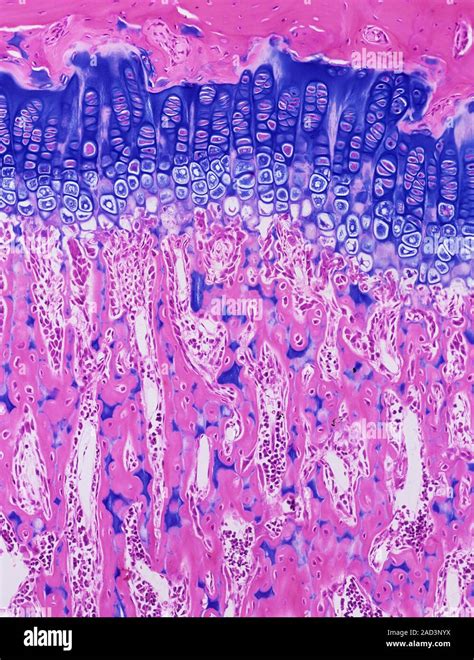 Light Microscopy Of A Epiphyseal Growth Plate In A Developing Bone The