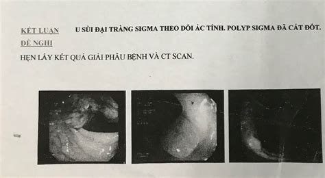 Vietnamese Medic Ultrasound Case Multiple Cancers Dr Phan Thanh