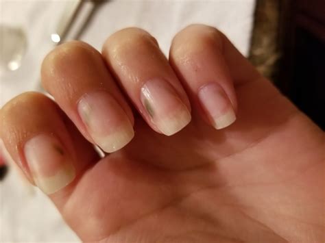 What Are These Green Spots On My Nails Diybeautyathome