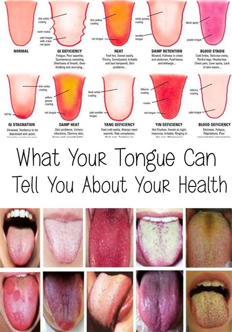 Which Tongue Are You Chart