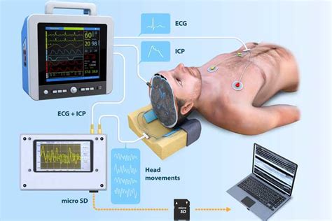 Intracranial Pressure Monitoring Device And Its Working