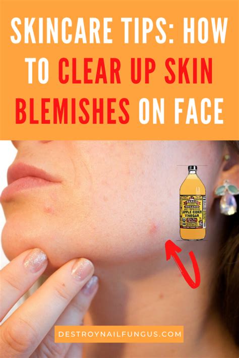 Clear Skin Guide How To Get Rid Of Blemishes On Your Face In 2020
