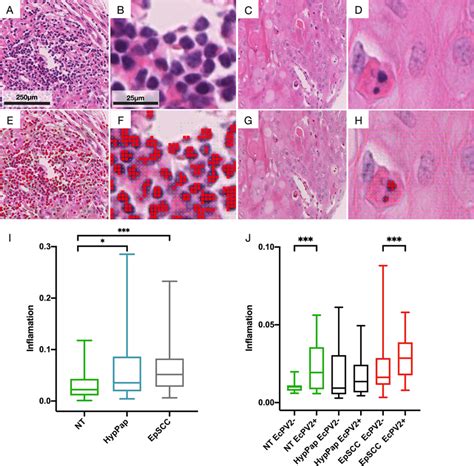 Quantification Of Inflammatory Cells On Hande Stained Tissue Cores A