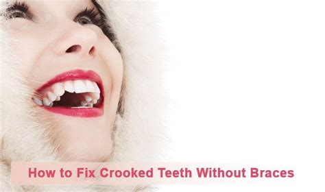 However, it really depends on what the condition your. How to Fix Crooked Teeth Without Braces - Life Cycle