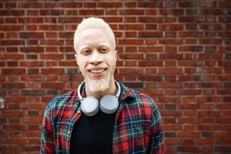 1400 Black Albino Person Stock Photos Pictures And Royalty Free Images