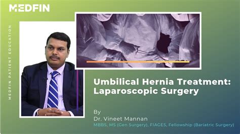 Umbilical Hernia Laparoscopic Surgery And Post Surgical Care Youtube