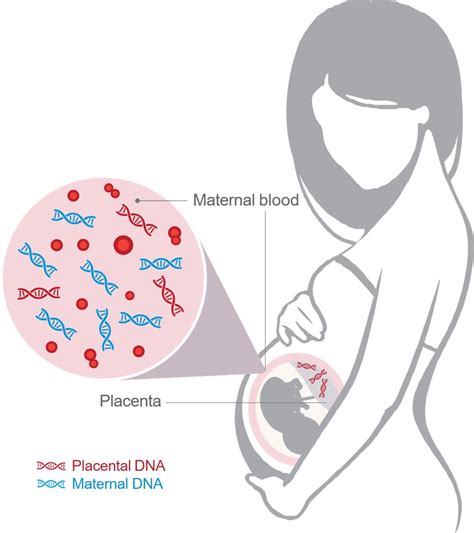 Why The ‘prenatal Peace Genetic Screening Test C27