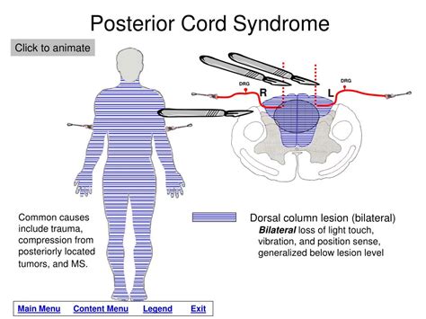 Ppt Lesions Of The Spinal Cord Powerpoint Presentation Free Download