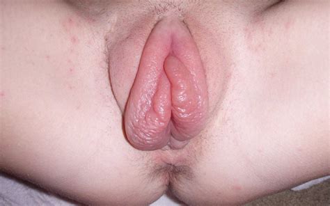 Big Clits And Pussy Lips Image 4 Fap