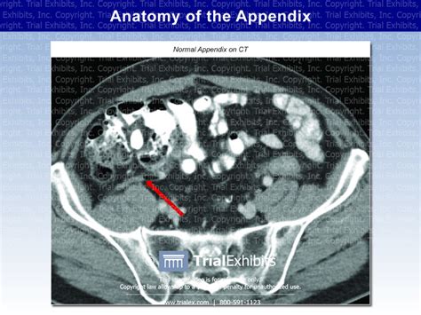Anatomy Of The Appendix Trial Exhibits Inc