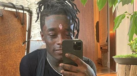 Rapper Lil Uzi Vert Gets Rid Of Multi Million Diamond He Implanted In