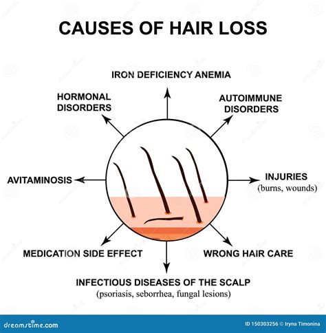 Causes Of Hair Loss The Structure Of The Skin And Hair Infographics