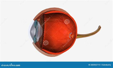 Uveitis Is Swelling And Irritation Of The Uvea The Middle Layer Stock