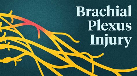 Brachial Plexus Injuries Care And Treatment Ausmed