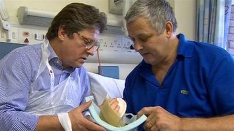 Hand Transplants To Be Offered To Uk Patients On Nhs Bbc News