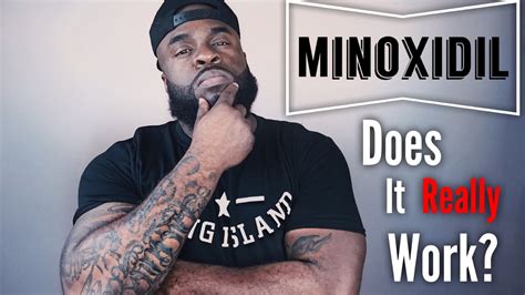 A blank line separates paragraphs, and. Does Minoxidil Really Work? | Minoxidil Beard Growth - YouTube