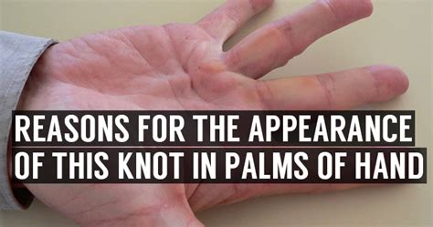 Knots And Lump In Palm Of Hands Symptoms And Home Treatment