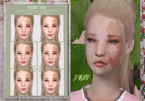Acne 05 The Sims 4 Skin Sims 4 Body Mods Sims