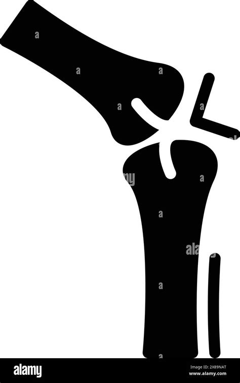 Icon For Jointarthritisrheumatism Stock Vector Image And Art Alamy