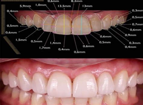 The Digital 3d Smile Designing For You Stunning Dentistry Blog