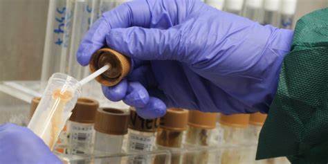 Анализ кала диеты