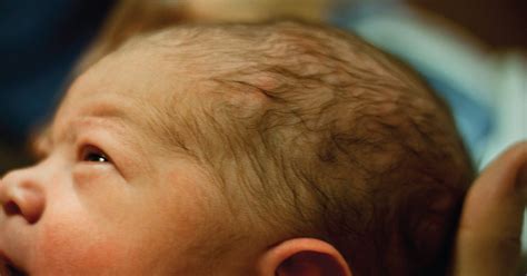 That Soft Spot On Your Babys Skull Explained