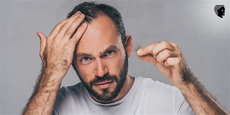 What Causes Hair Loss Understanding Your Hair Loss Problem Is Critical
