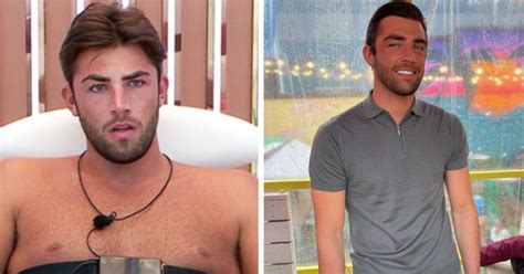 Love Island Transformations Ex Islanders Look Totally Different Then