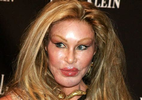 8 Celebrity Plastic Surgery Gone Bad Really Bad News Stories