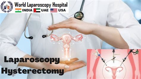 How To Perform Laparoscopic Hysterectomy Step By Step What Are The