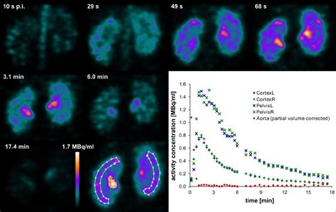 Dynamic 99m Tc Mag3 Spect In A Healthy Mouse Acquired In Download