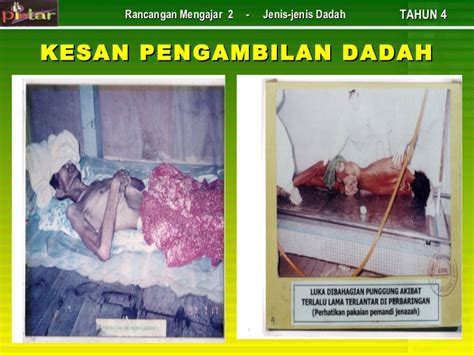 Apakah jenis jenis dadah dan kesannya. Jenis-Jenis Dadah