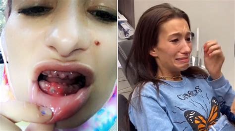 Us Woman Undergoes Stunning Transformation With 38k New Teeth After