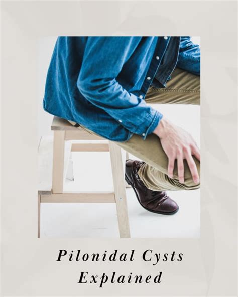 Definitive Guide To Pilonidal Cysts My Experience Patients Lounge