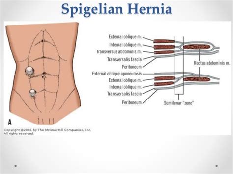 Surgical Anatomy Of Anterior Abdominal Wall