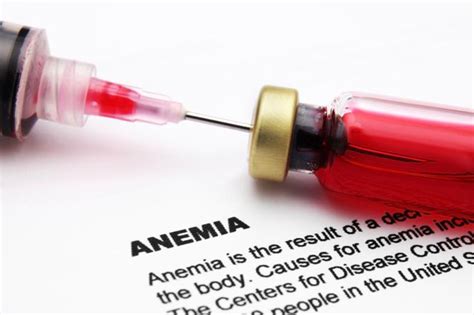 Niedokrwisto Anemia Z O Liwa Przyczyny I Objawy Choroba Addisona Biermera Leczenie