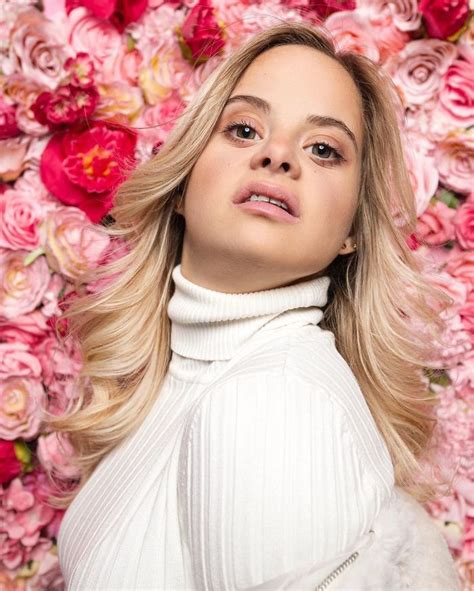 This Model With Down Syndrome Posed For The Most Romantic