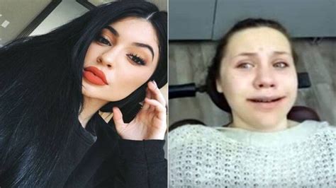 Watch Girl Wakes Up From Surgery Convinced She Is Kylie Jenner And Is