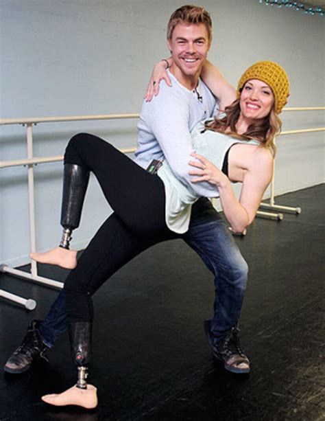 Dancing Darling Amy Purdy Her Story Of Survival And Life Leading Up