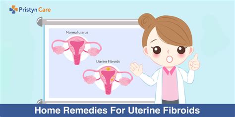 Home Remedies For Uterine Fibroids Pristyn Care