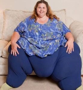 Fotografia Da Mulher Mais Gorda Do Mundo Obesa Com Kg Confira