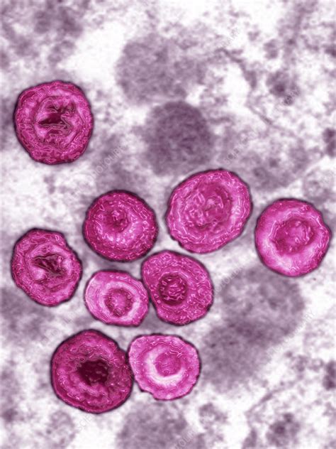 Cytomegalovirus Stock Image C0171727 Science Photo Library